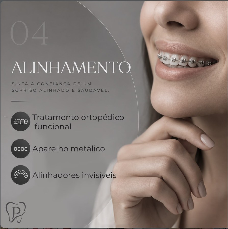 Alinhamento